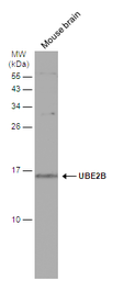 Anti-UBE2B antibody used in Western Blot (WB). GTX100416