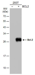 Anti-Bcl-2 antibody used in Western Blot (WB). GTX100440