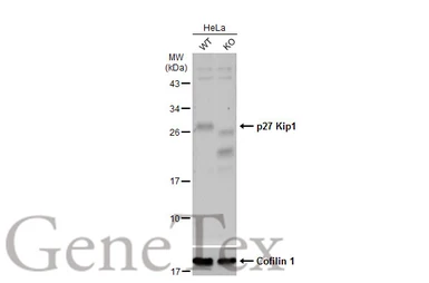 Anti-p27 Kip1 antibody used in Western Blot (WB). GTX100446