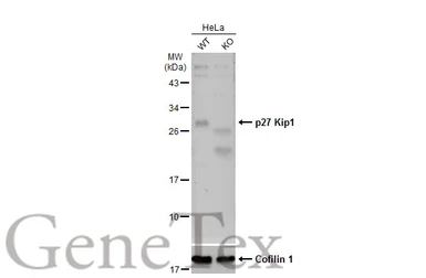 Anti-p27 Kip1 antibody used in Western Blot (WB). GTX100446