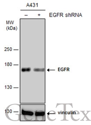 Anti-EGFR antibody [C2C3], C-term used in Western Blot (WB). GTX100448