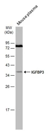 Anti-IGFBP3 antibody [N2C3] used in Western Blot (WB). GTX100454