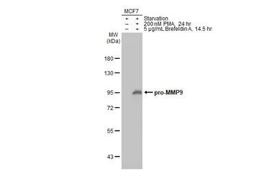 Anti-MMP9 antibody [N2C1], Internal used in Western Blot (WB). GTX100458