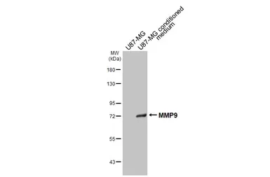 Anti-MMP9 antibody [N2C1], Internal used in Western Blot (WB). GTX100458