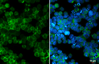 Anti-PI3 kinase p110 alpha antibody used in Immunocytochemistry/ Immunofluorescence (ICC/IF). GTX100462