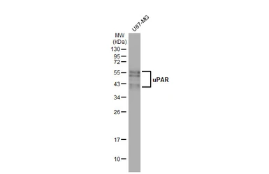 Anti-uPAR antibody used in Western Blot (WB). GTX100467
