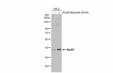 Anti-Rad51 antibody [N1C2] used in Western Blot (WB). GTX100469