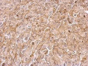 Anti-MASPIN antibody used in IHC (Paraffin sections) (IHC-P). GTX100471