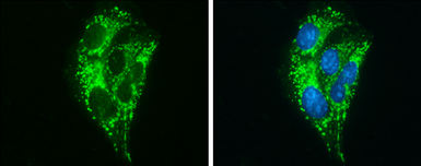 Anti-ABAT antibody used in Immunocytochemistry/ Immunofluorescence (ICC/IF). GTX100479