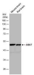 Anti-ABAT antibody used in Western Blot (WB). GTX100479
