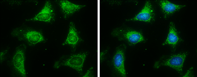 Anti-ACADM antibody used in Immunocytochemistry/ Immunofluorescence (ICC/IF). GTX100487