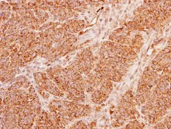 Anti-ACADM antibody used in IHC (Paraffin sections) (IHC-P). GTX100487