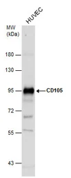 Anti-CD105 antibody [N3C3] used in Western Blot (WB). GTX100508