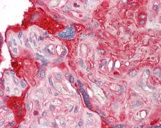 Anti-Fibronectin antibody [C3], C-term used in IHC (Paraffin sections) (IHC-P). GTX100510