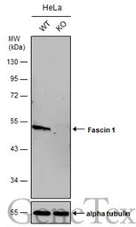 Anti-Fascin 1 antibody [N2C2], Internal used in Western Blot (WB). GTX100511