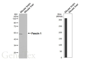 Anti-Fascin 1 antibody [N2C2], Internal used in Western Blot (WB). GTX100511