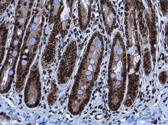 Anti-HMGA2 antibody - ChIP grade used in IHC (Paraffin sections) (IHC-P). GTX100519