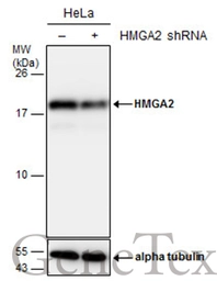Anti-HMGA2 antibody - ChIP grade used in Western Blot (WB). GTX100519