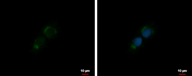 Anti-IGF1 antibody used in Immunocytochemistry/ Immunofluorescence (ICC/IF). GTX100521
