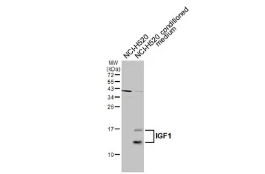 Anti-IGF1 antibody used in Western Blot (WB). GTX100521