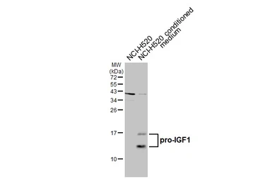 Anti-IGF1 antibody used in Western Blot (WB). GTX100521