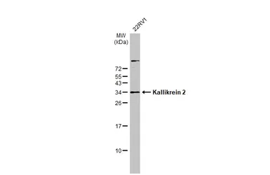 Anti-Kallikrein 2 antibody [N3C3] used in Western Blot (WB). GTX100526