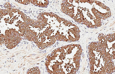 Anti-Kallikrein 2 antibody [N3C3] used in IHC (Paraffin sections) (IHC-P). GTX100526