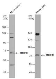 Anti-MTHFR antibody [N3C3] used in Western Blot (WB). GTX100535