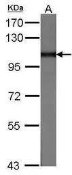 Anti-MVP/LRP antibody [C2C3], C-term used in Western Blot (WB). GTX100536