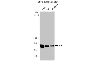 Anti-Rb antibody used in Western Blot (WB). GTX100545