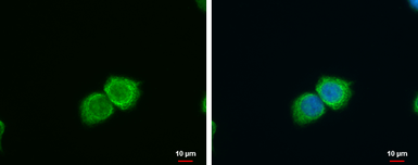 Anti-SFXN4 antibody used in Immunocytochemistry/ Immunofluorescence (ICC/IF). GTX100551