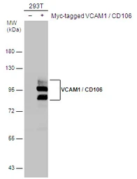 Anti-VCAM1 / CD106 antibody used in Western Blot (WB). GTX100562