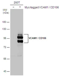 Anti-VCAM1 / CD106 antibody used in Western Blot (WB). GTX100562