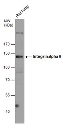 Anti-Integrin alpha 6 antibody [N3C2], Internal used in Western Blot (WB). GTX100565