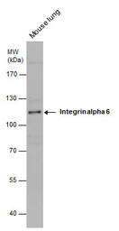Anti-Integrin alpha 6 antibody [N3C2], Internal used in Western Blot (WB). GTX100565