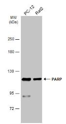 Anti-PARP antibody used in Western Blot (WB). GTX100573
