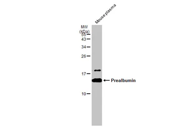 Anti-Prealbumin antibody [N1C3] used in Western Blot (WB). GTX100577