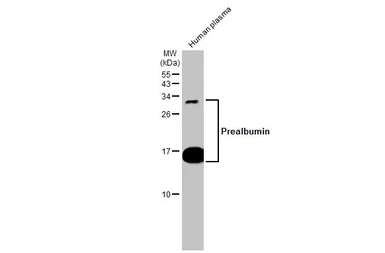 Anti-Prealbumin antibody [N1C3] used in Western Blot (WB). GTX100577