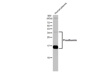 Anti-Prealbumin antibody [N1C3] used in Western Blot (WB). GTX100577