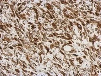 Anti-AGR3 antibody used in IHC (Paraffin sections) (IHC-P). GTX100582