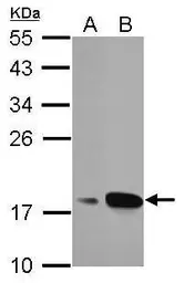 Anti-AGR3 antibody used in Western Blot (WB). GTX100582