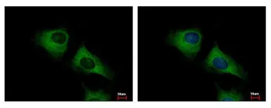 Anti-SCARA3 antibody [N2C2], Internal used in Immunocytochemistry/ Immunofluorescence (ICC/IF). GTX100595