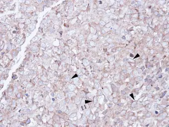 Anti-SCARA3 antibody [N2C2], Internal used in IHC (Paraffin sections) (IHC-P). GTX100595