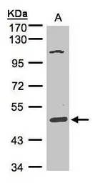 Anti-SCARA3 antibody [N2C2], Internal used in Western Blot (WB). GTX100595