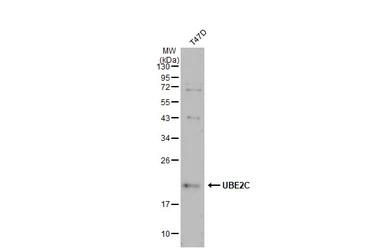 Anti-UBE2C antibody [N1C3] used in Western Blot (WB). GTX100599