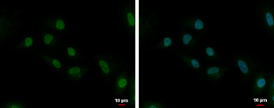 Anti-UBE2C antibody [N1C3] used in Immunocytochemistry/ Immunofluorescence (ICC/IF). GTX100599