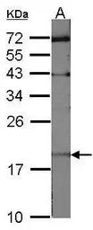 Anti-UBE2C antibody [N1C3] used in Western Blot (WB). GTX100599