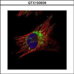 Anti-TID1 antibody used in Immunocytochemistry/ Immunofluorescence (ICC/IF). GTX100608