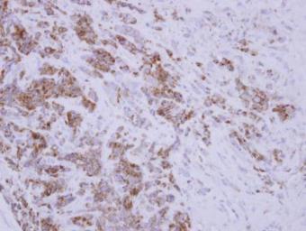 Anti-TID1 antibody used in IHC (Paraffin sections) (IHC-P). GTX100608