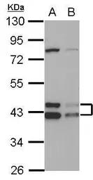 Anti-TID1 antibody used in Western Blot (WB). GTX100608